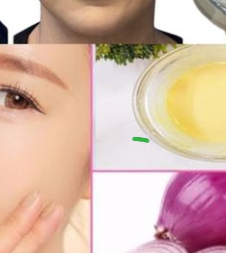 Unlock the Anti-Aging Secrets of Onions for Wrinkle-Free Skin