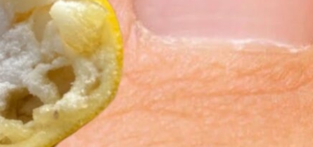 100% No Fungi on Nails! Natural Therapy for Healthy and Shiny Nails Using Lemon and Salt